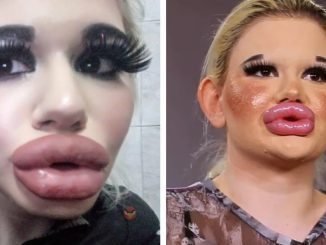 “She Was Such a Nice Girl”: What Does The Girl Who Underwent Over 20 Plastic Surgeries Look Like Before All The Cosmetic Interventions?