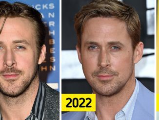 Ryan Gosling’s Face is “Ruined” By Fillers According to Shocked Fans