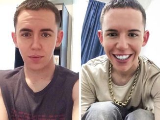 It’s Really Amazing How Similar: The Man Spent Over 0,000 on Plastic Surgery to Make Himself Seem Like Britney Spears!