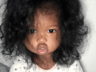 This baby with big lips, the daughter of a Kenyan mother and a Laotian father, has grown up quite a bit. See how she looks after 12 years…