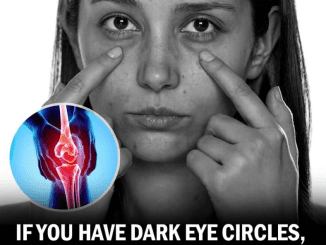 If You Have Dark Eye Circles, Your Body May Be Trying to Warn You