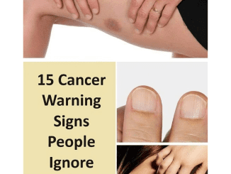 15 Cancer Warning Signs People Ignore Until It’s Too Late