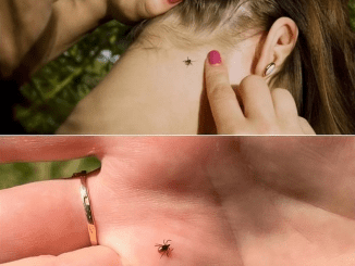 They are already awake. What to do immediately if you are bitten by a tick