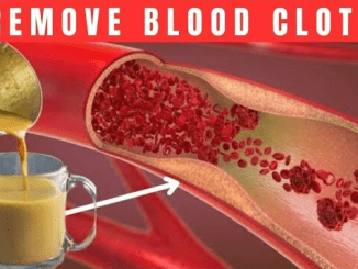 1 Cup a Day and You Will Never Get a Blood Clot: Turmericand Ginger Drink