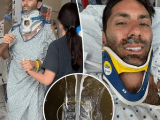 MTV’s ‘Catfish’ host Nev Schulman breaks neck, recovering from bike accident