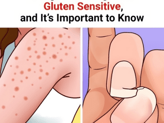 9 Signs You’re Gluten Sensitive, and This Is Important to Know