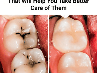 8 Tips and Facts About Teeth That Will Help You Take Better Care of Them