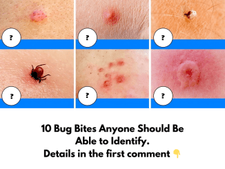 10 Bug Bites Anyone Should Be Able to Identify