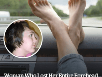 Woman who lost her entire forehead issued stark warning to people who put their feet on the dashboard