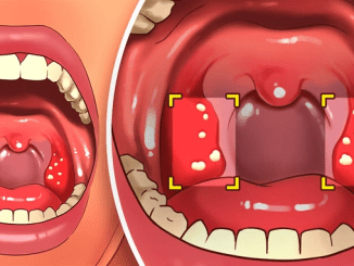 6 Effective Ways To Avoid Bad Breath Even After Sleeping