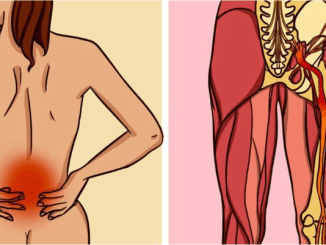 Do you suffer from pain in your lower back? Here’s what to do about sciatica