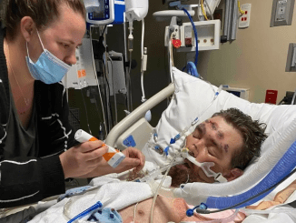 Man placed in coma with just 4% chances of survival after trying to remove ingrown hair