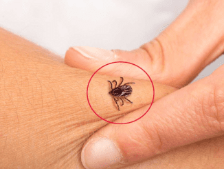 How to identify a tick bite & what to do immediately