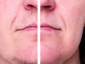 My nana swears by this trick to remove chin and other facial hair. Here’s how it works