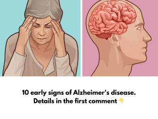 The facts about Alzheimer’s 