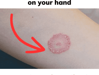 What Are These Round, Red, Itchy, Scaly Patches? Causes and Treatments