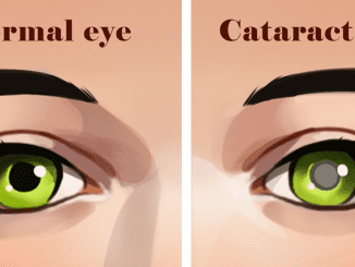 Here are 6 things you should be doing at home if you have cataracts