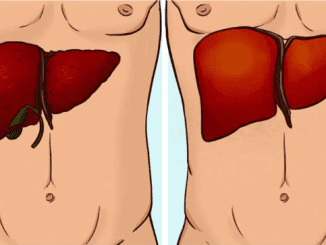 Know how to tell if you’re experiencing liver failure by looking out for these symptoms