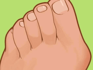 That painful bump on the side of your feet? Here’s how to get ridof it