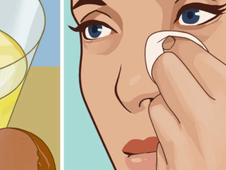 6 natural ways to get rid of puffy eyes