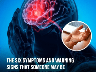 The six symptoms and warning signs that someone may be suffering from a stroke