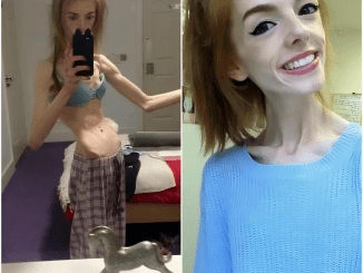 This woman only ate one piece of bread a day for 5 years – but look at her now