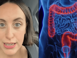 Woman diagnosed with bowel cancer aged 25 reveals unusual symptom all young people should know