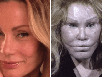 Jocelyn Wildenstein: The Transformation of ‘Catwoman’ and Her Claim to Natural Beauty