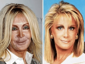 Joan Van Ark: Examining Her Legacy and the Speculation Around Her Appearance